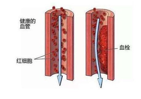 猕猴桃吃了有什么好处